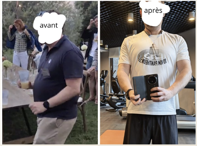 Photo avant / après d'Arnaud