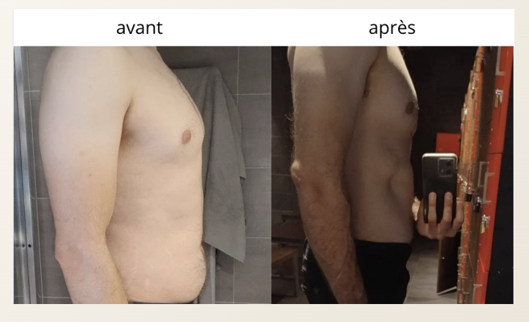 Photo avant / après de Nicolas